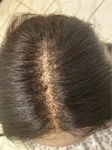 Wig photo 3