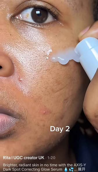 Dark Spot Correcting Serum photo 4